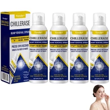 Timilk Chill Erase Bump Renewal Spray, Advanced Salicylic Acid Body Spray-60ml