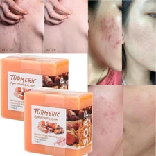 2PACK Tumeric Soap, Dark Spots , Skin Glow, Brighter Skin, Scars, All Skin types