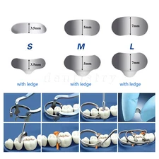 Dental Sectional Matrix System Contoured Metal Matrices Refill Matrix Bands 50Pc