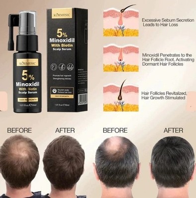 KORMESIC 5% Minoxidil Biotin scalp serum 30 ml | eBay