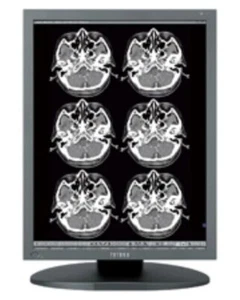 Totoku ME253i2 21,3" 2MP Graustufen monochrom LCD Display medizinischer Monitor - NEU! - Bild 1 von 1