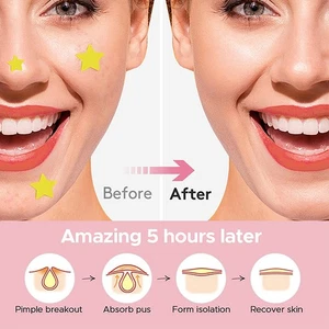 240 PCS/SET Pimple Patch Acne Colorful Invisible Acne Removal Skin Care Stickers - Picture 1 of 7
