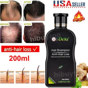 200ml DEXE Anti-Hair Loss Shampoo Natural Ginger Serum Hair Fast Growth Shampoo - Picture 1 of 12