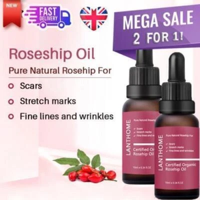 20ML🌟 Organic Rosehip Oil for Face, use of Scars, Stretch Marks & Wrinkles ✅🔥 - Image 1 of 4