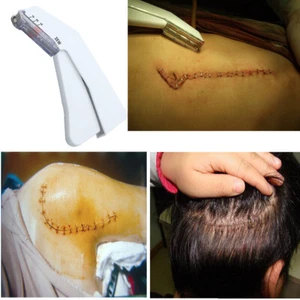 Nueva grapadora veterinaria grapadora para piel de 1 pieza -35 estéril caza mascota perro primeros auxilios - Imagen 1 de 8