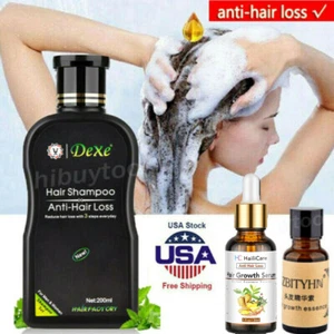 200ml Ginger Anti Hair Loss Shampoo Treatment/ 30ml Fast Hair Growth Oil Serum - Picture 1 of 13