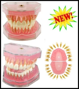 Dental Standard Removable Teeth Study Teach Model Soft Gums Silica Gel Anatomy - Picture 1 of 7