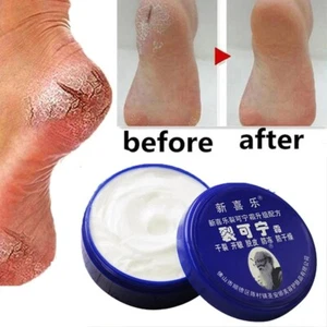 Herbal Anti Crack Foot Cream Oil Anti-Drying Moisturizing Feet Cream 85g - Picture 1 of 5