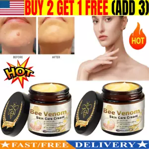 All-Body Powerful Skin Treatment Cream, Bee Venom Skin Treatment Cream US Hot~ - Picture 1 of 10