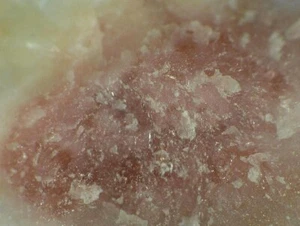 REINHARDBRAUNSITE from Eifel, Germany *  TYPE LOCALITY SPECIMEN  * 1,4 cm - Picture 1 of 3