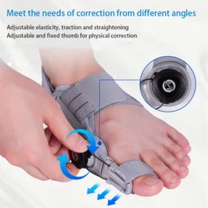 Treatmedy Bunion Fix Toe Valgus Corrector 2024 Foot Pain Relief Toe Straightener - Picture 1 of 13