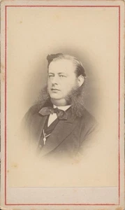 CDV Antique Photo Man Long Sideburns Goiter? Kalmar Sweden John Dryselius 1871 - Picture 1 of 7