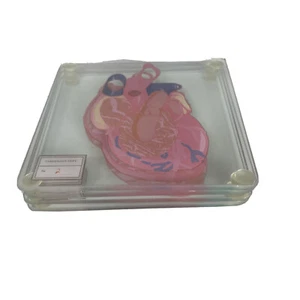 Anatomic Heart Specimen Medical Coasters Table Drink Coaster . Only Slides 2-5 - Picture 1 of 6