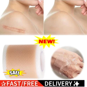 Narbenpflaster, Silikon-Narbenpaste, entfernt effektiv Narben wiederverwen-Neu. - Picture 1 of 23