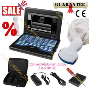 CE&FDA,Portable laptop machine Digital Ultrasound scanner,3.5M Convex probe,New - Picture 1 of 11