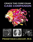 Prometheus Lionhart M D Crack the CORE Exam - Case Companion (Paperback)