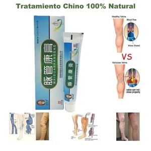 Crema Para Eliminar Rápido Las Varices Y Arañitas Vasculares Tratamiento NATURAL - Picture 1 of 6