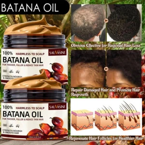 2~Batana Oil Conditioner for Hair Growth,Anti Hair Loss,Healthier Thicker Fuller - Picture 1 of 24