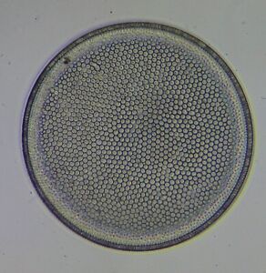 Antique Microscope Slide by W.A.Firth. Diatom. "Coscinodiscus incretus". U.S.A.