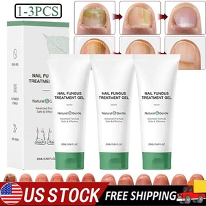 Nutraboost Nagelpilz Behandlung Gel, Nagelpilz, Pilzcreme (1-5 Stück) - Bild 1 von 18