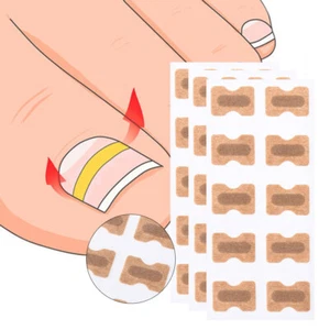 10/20/30/50Pcs Glue Free Toenail Toe Ingrown Nail Correction Patch Nail Sticker~ - Bild 1 von 14