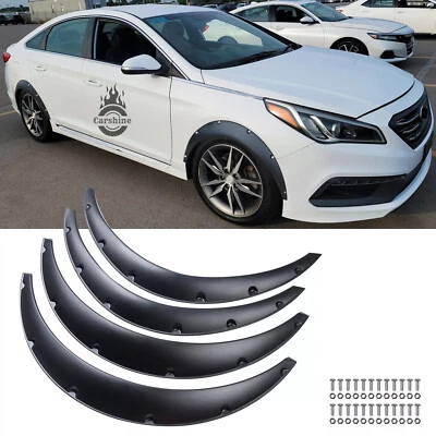 For Hyundai Sonata Elantra Fender Flares Extra Wide Flexible Wheel Arches Black Foto 1 de 4
