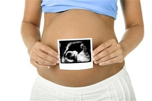 Business Plan: 3D-4D Baby IMAGING ULTRASOUND Service - Image 1 of 1