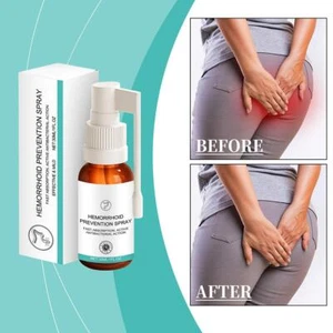 1* Natural Hemorrhoids Spray Hemorrhoid Treatment Alleviate Pain Spray -🔥 - Foto 1 di 18