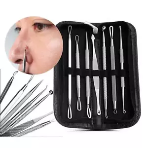 Kit de herramientas de eliminación de espinillas removedor de manchas extractor de espinillas de acné popper comedón - Imagen 1 de 8
