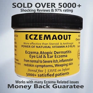 Contact dermatitis eczema cream non steroid - Picture 1 of 12