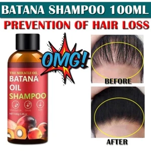 3in1 Hair Growth shampoo With Biotin, Batana Oil, Rosemary Oil - Picture 1 of 7