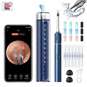 Ear Wax Removal Tool with Tweezers, Ear Cleaner with FHD Camera, Cleaning Earwax - Picture 1 of 12