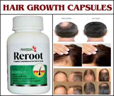 Suplementos dietéticos para el crecimiento del cabello natural vegano fuerza profesional Reroot Foto 1 de 4
