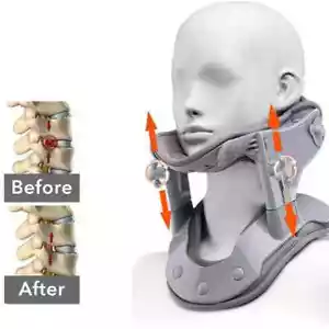 Dispositivo de tracción de cuello Kit de corrección de cuello cervical Cuello retractor Estirador - Imagen 1 de 11