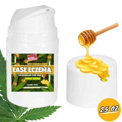  Raw Manuka Honey Healing Eczema cream - Psoriasis Good For Forehead Foto 1 de 4