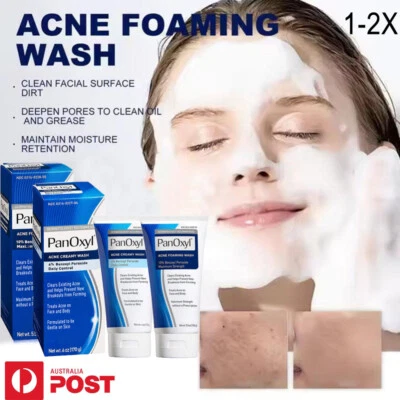 PanOxyl Benzoyl Peroxide 10% Foaming Acne Wash Skin Care 4% Daily Control Cream - image 1 of 4