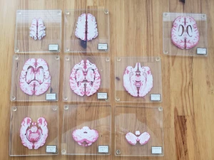 3D Anatomische Gehirn Scheiben Probe Untersetzer 9 Stück Set Glas Getränke THINKGEEK 4x4" - Bild 1 von 7