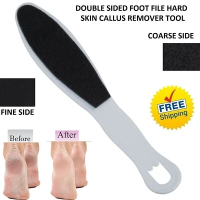 Foot File Pedicure Double Sided Rasp Dead Skin Callus Remover Sanding Tool - Image 1 of 3
