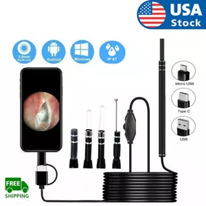 LED Endoscopio de oído HD Otoscopio Cera de oído Limpieza Cámara Herramienta Limpiador Kit de eliminación - Imagen 1 de 9