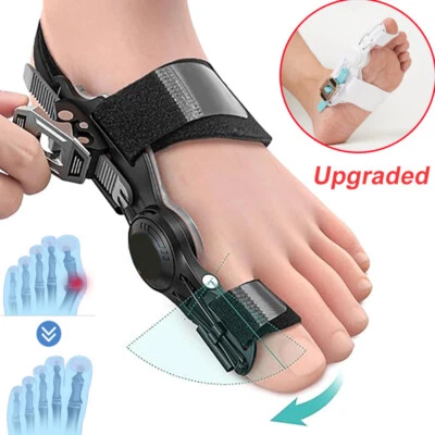 Hallux Valgus Bunion Corrector Big Toe Straightener Splint Separator Pain Relief - Image 1 of 4