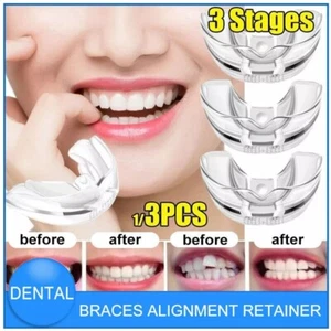 Dental Orthodontic Teeth Corrector Braces Tooth Retainer Straighten Tool 3 Stage - Picture 1 of 11