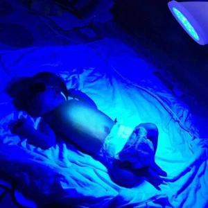 Neonatal Jaundice Baby Blue Light LED Spot Lamp for Reduce Baby Jaundice - Picture 1 of 12