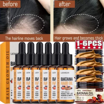 6/3x Batana Oil Serum,Organic&Natural Batana Oil for Hair Growth,Anti Hair Loss - Image 1 of 4