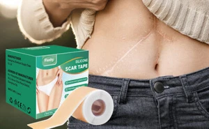 Scar Silicone Sheet Gel Patch Removal Skin Treatment Repair Wound Burn Natural - Picture 1 of 11