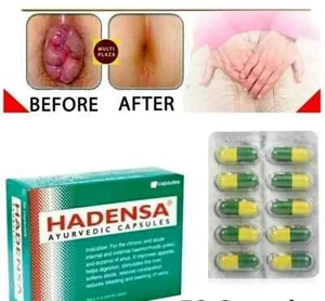 Hadensa Ayurveda 50 Tabletten Hämorrhoiden & Hämorrhoiden Schmerzlinderung Juckreiz Schwellung - Bild 1 von 5