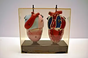 Vintage Anatomical Heart Model in Acrylic Case Educational Medical Display Rare - Picture 1 of 12