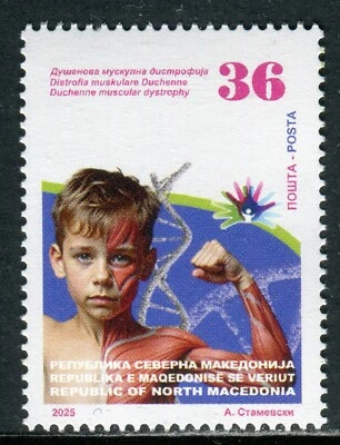 457 - NORTH MACEDONIA 2025 - Children with rare diseases - Medical - MNH - Image 1 of 2