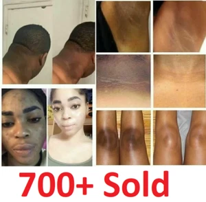 Dark Skin Bleaching Cream Whitening Lightening AHA - Face & Body |- 15g - Picture 1 of 12