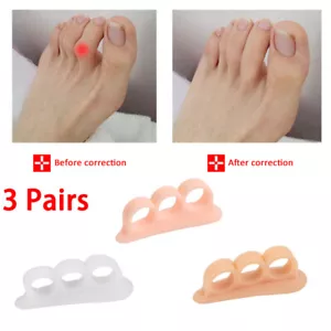 6PCS Silicone Bunion Toe Corrector Orthotics Straightener Separator Pain Foot - Picture 1 of 12