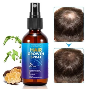 HAIR GROWTH SERUM Anti HAIR LOSS TREATMENT SPRAY REGROW NEW HAIR MINOXIDIL 5% - Picture 1 of 11